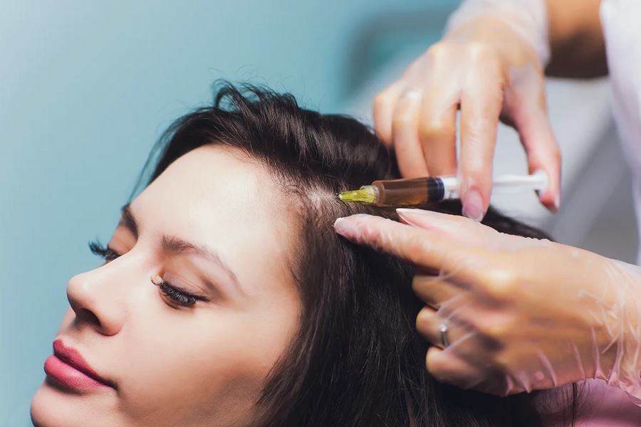 PRP Therapy for Hair Health: A Comprehensive Exploration